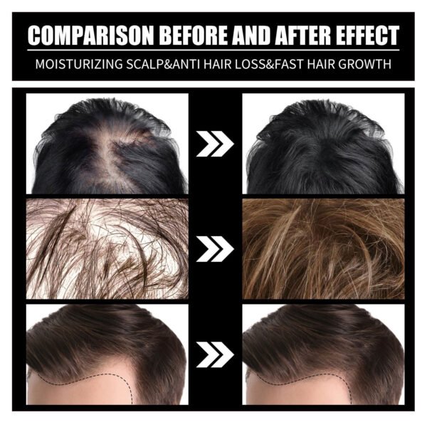 Liquid Biotin & Collagen Hair Growth Drops  - Biotin And Liquid Collagen Supplement For Men & Women - Glowing Skin Support, Healthy Hair & Nail Growth - Image 4